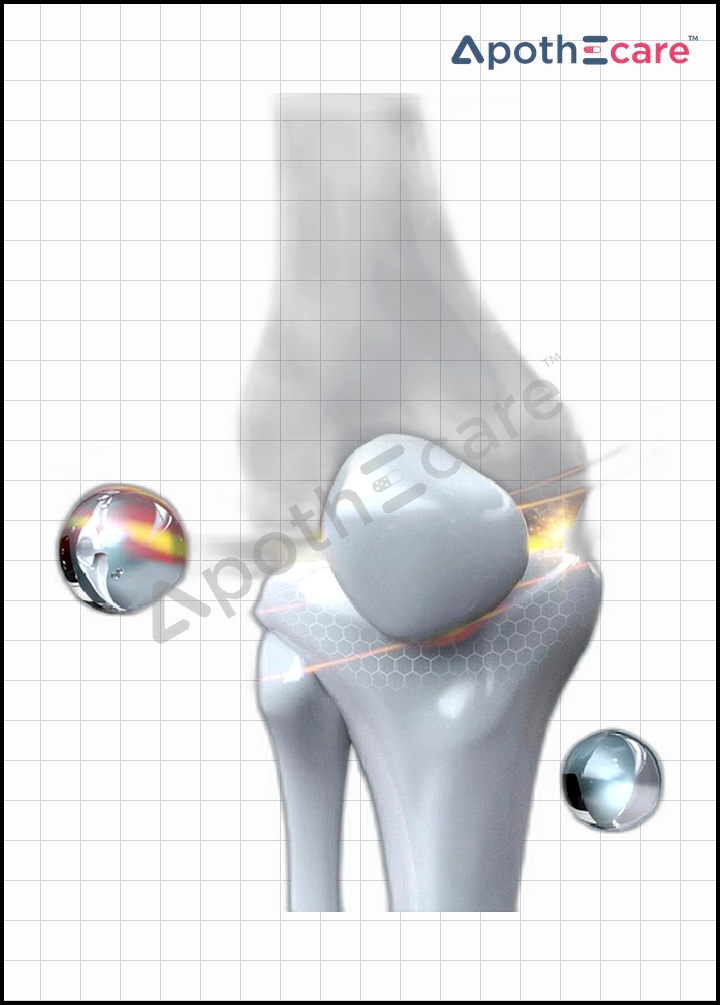 Top Supplements for Healthy Bones: Vitamin D, Calcium, and More